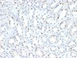 STAT6 (Solitary Fibrous Tumor Marker) Antibody in Immunohistochemistry (Paraffin) (IHC (P))
