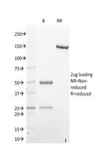 STAT6 (Solitary Fibrous Tumor Marker) Antibody in SDS-PAGE (SDS-PAGE)