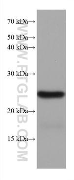 TPPP Antibody in Western Blot (WB)