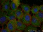 HSPA6 Antibody in Immunocytochemistry (ICC/IF)