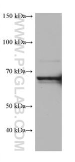 HSPA6 Antibody in Western Blot (WB)