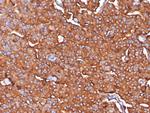 Synaptophysin (Neuroendocrine Marker) Antibody in Immunohistochemistry (Paraffin) (IHC (P))