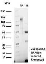 Synaptophysin (Neuroendocrine Marker) Antibody in SDS-PAGE (SDS-PAGE)