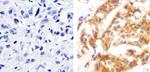 Phospho-c-Met (Tyr1230, Tyr1234, Tyr1235) Antibody in Immunohistochemistry (Paraffin) (IHC (P))