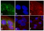 Phospho-FAK (Tyr397) Antibody in Immunocytochemistry (ICC/IF)