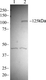 Phospho-FAK (Tyr397) Antibody in Western Blot (WB)