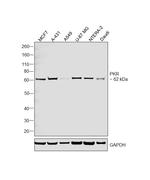 PKR Antibody in Western Blot (WB)