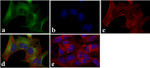 LC3B Antibody in Immunocytochemistry (ICC/IF)