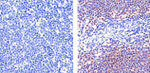 STAT6 Antibody in Immunohistochemistry (Paraffin) (IHC (P))