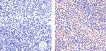 STAT6 Antibody in Immunohistochemistry (Paraffin) (IHC (P))