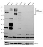 CD56 Antibody in Western Blot (WB)