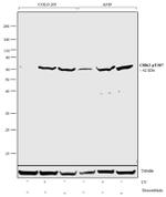 Phospho-CHK2 (Thr387) Antibody in Western Blot (WB)