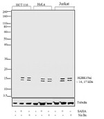 H2BK15ac Antibody in Western Blot (WB)