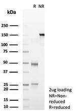 Transferrin (Early Marker of Oligodendrocytes) Antibody in SDS-PAGE (SDS-PAGE)