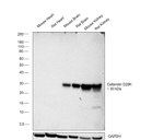 Calbindin D28K Antibody in Western Blot (WB)