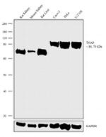 ALPL Antibody in Western Blot (WB)