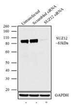 SUZ12 Antibody in Western Blot (WB)