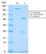pS2/pNR-2/TFF1 (Estrogen-Regulated Protein) Antibody in SDS-PAGE (SDS-PAGE)