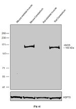 nNOS Antibody in Western Blot (WB)