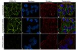 CMKLR1 Antibody