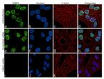 53BP1 Antibody in Immunocytochemistry (ICC/IF)