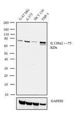 IL13RA2 Antibody in Western Blot (WB)