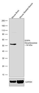 DOPA decarboxylase Antibody in Western Blot (WB)
