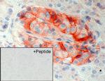 SSTR5 Antibody in Immunohistochemistry (IHC)