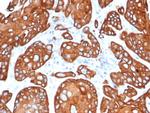 TIMP1 (Marker of Lymph Node Metastasis) Antibody in Immunohistochemistry (Paraffin) (IHC (P))