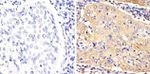 STAT3 Antibody in Immunohistochemistry (Paraffin) (IHC (P))