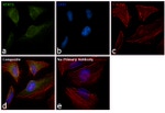 STAT3 Antibody in Immunocytochemistry (ICC/IF)