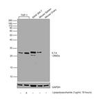 IL-1 beta Antibody in Western Blot (WB)