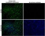 S100B Antibody in Immunohistochemistry (Paraffin) (IHC (P))