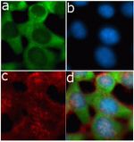 TIMP3 Antibody in Immunocytochemistry (ICC/IF)