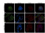 Protein APC Antibody in Immunocytochemistry (ICC/IF)