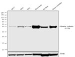 Glutamine Synthetase Antibody in Western Blot (WB)