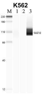 SUZ12 Antibody in RNA Immunoprecipitation (RIP)