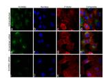 LIMP2 Antibody in Immunocytochemistry (ICC/IF)