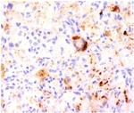 TNF-alpha (TumorNecrosis Factor alpha) Antibody in Immunohistochemistry (Paraffin) (IHC (P))