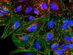 beta Catenin Antibody in Immunocytochemistry (ICC/IF)