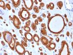 TPO (Thyroid Peroxidase) (Thyroid Marker) Antibody in Immunohistochemistry (Paraffin) (IHC (P))