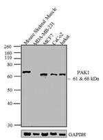 PAK1 Antibody in Western Blot (WB)