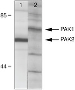 PAK1 Antibody in Western Blot (WB)