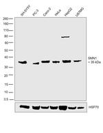 SMN1 Antibody in Western Blot (WB)