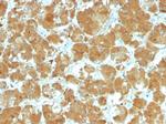 TSH-Receptor, A-Chain (Thyroid Marker) Antibody in Immunohistochemistry (Paraffin) (IHC (P))