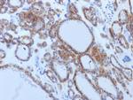 TSH-Receptor, B-Chain Antibody in Immunohistochemistry (Paraffin) (IHC (P))