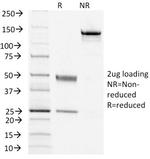 TSH-Receptor, B-Chain Antibody in SDS-PAGE (SDS-PAGE)