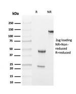 Transthyretin (Prealbumin) Antibody in SDS-PAGE (SDS-PAGE)