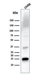 Transthyretin (Prealbumin) Antibody in Western Blot (WB)