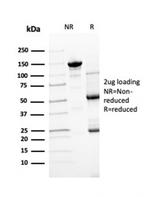 Transthyretin (Prealbumin) Antibody in SDS-PAGE (SDS-PAGE)